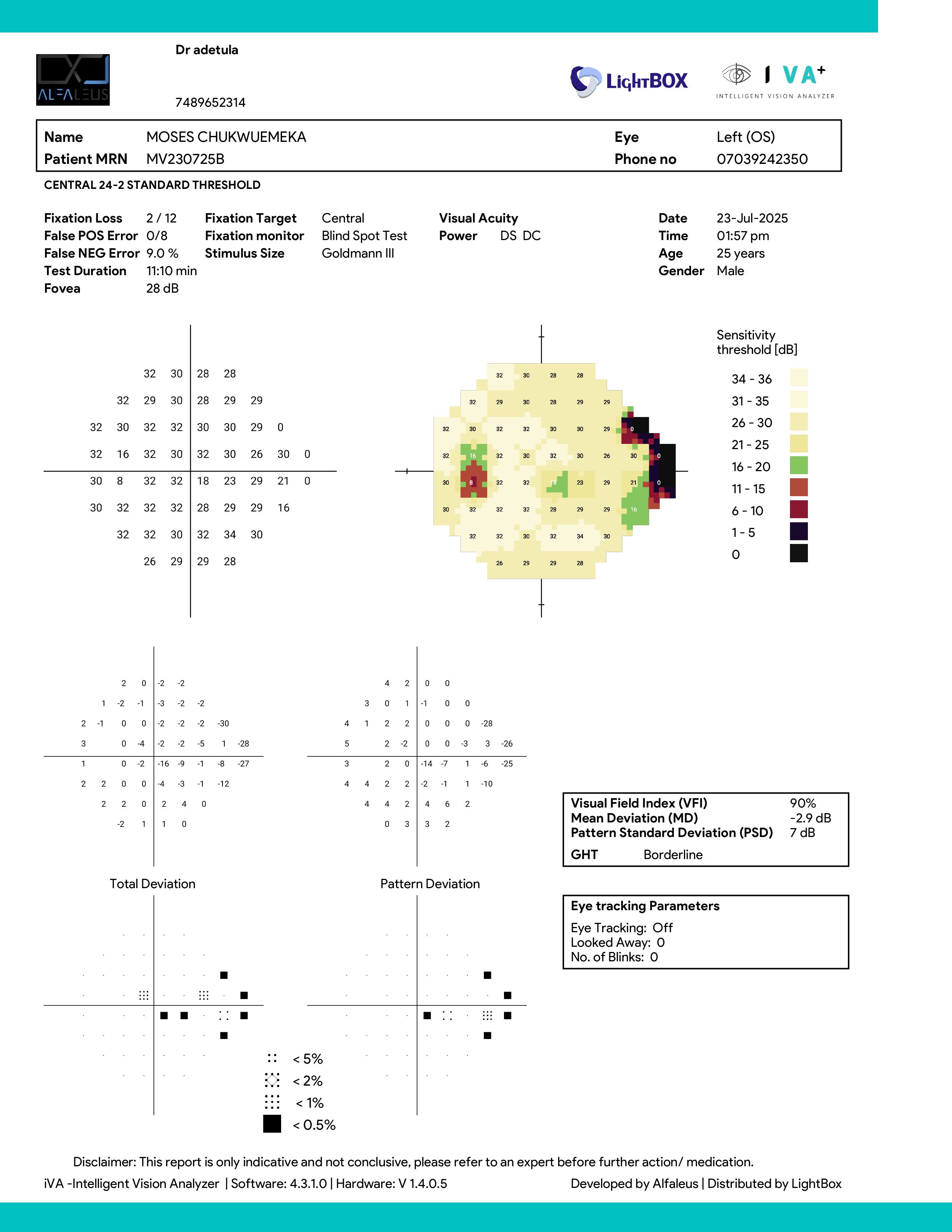 CVF (Central Visual Field) Scan: Severe Vision Field Loss - Right Eye